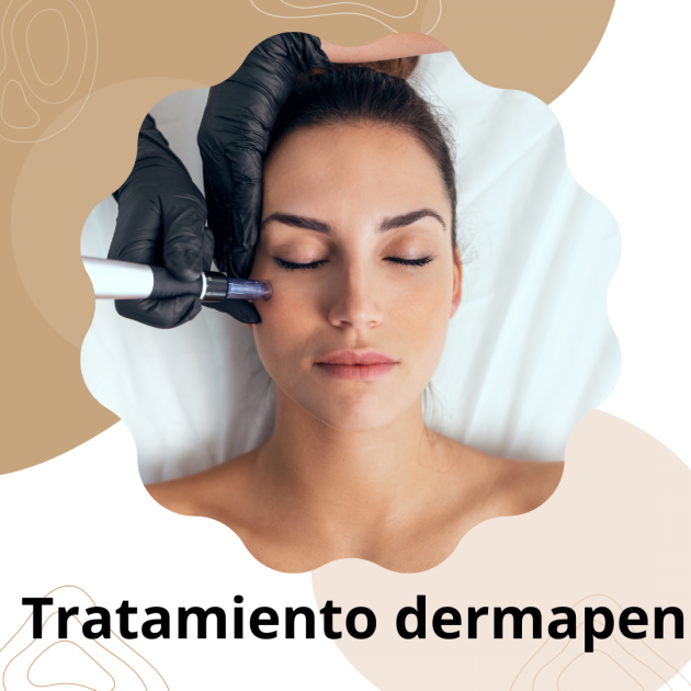 Tratamiento con Dermapen (Empitsu)