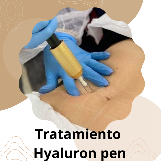 Tratamientos Faciales y corporales con Hyaluron pen