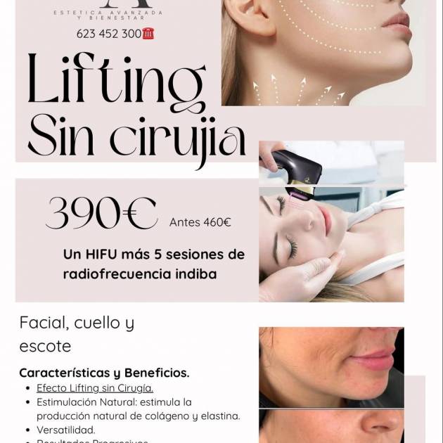 Lifting sin Cirugia